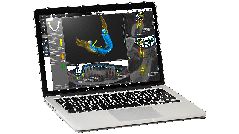 ACTEON AIS Software