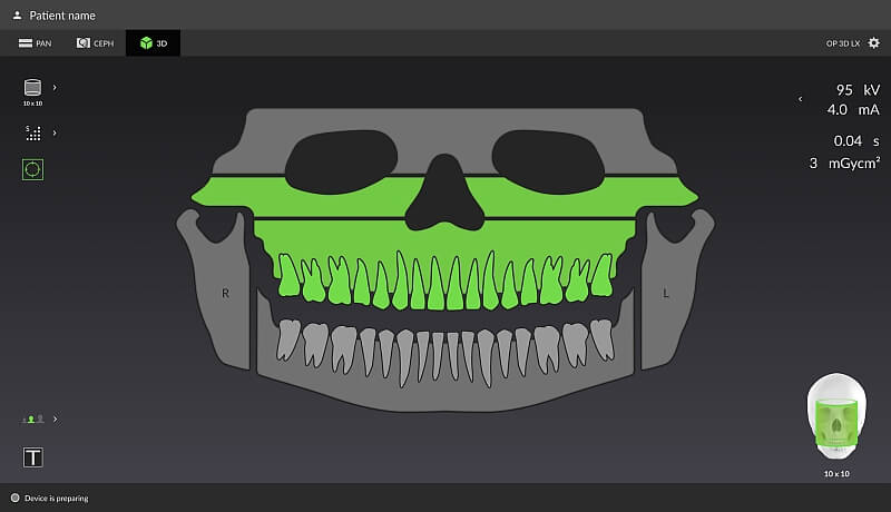 DEXIS OP 3D LX